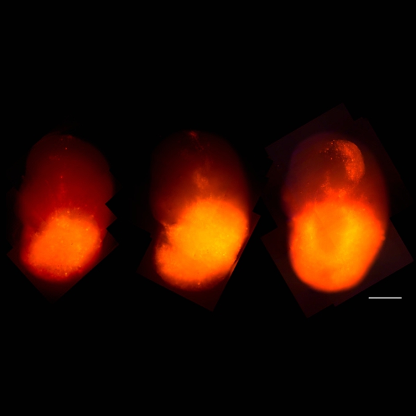 Růst nádoru v editovaném organoidu, zviditelněný fluorescencí tdTomato. Kredit: Salk Institute.