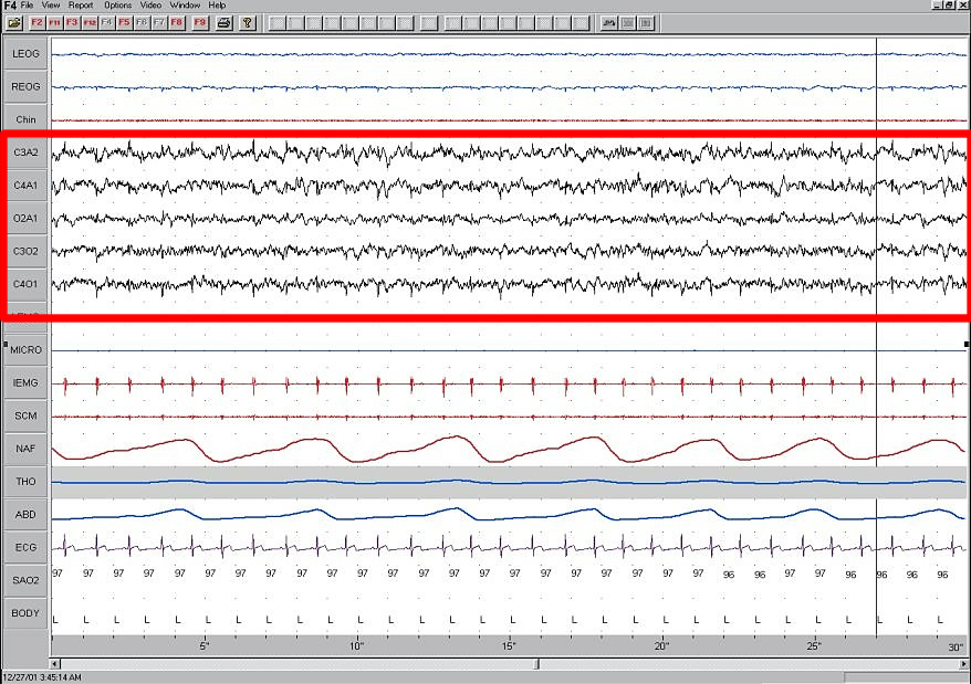 Záznam elektrického potenciálu v době spánku (EEG) svědčí o vysoké  mozkové aktivitě. Při přednáškách v posluchárně rád  lenoší - viz zde.  http://richmerlo.blogspot.com/2013/10/
