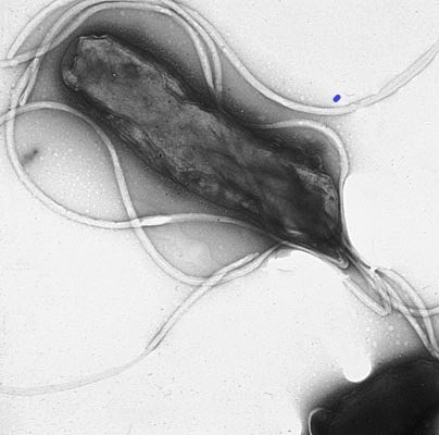 Helicobacter pylori (název složen ze slov: „helix“– šroubovice, „bacter“– bakterie, „pylorus“– vrátník) je druh mikroaerofilní gramnegativní patogenní bakterie, jež napadá sliznici žaludku. Odhaduje se, že je ve vyspělých zemích touto bakterií infiko