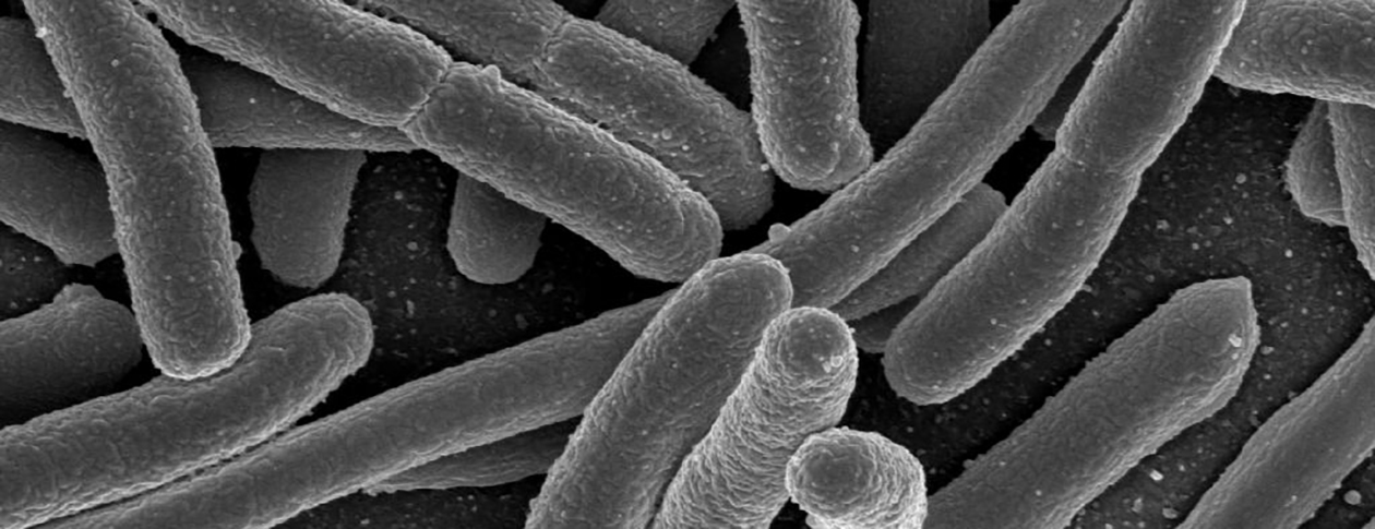 Dobrý sluha, zlý pán. Snímek bakterie Escherichia coli pořízený elektronovým skenovacím mikroskopem. Kredit: Rocky Mountain Laboratories, NIAID, NIH. Public domain.