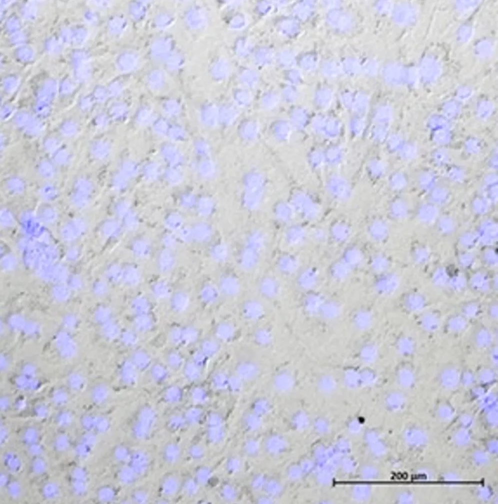 Na obrázku jsou rozptýlené buňky, které mají vřetenovitý tvar. To je pro kulturu fibroblastů charakteristické. Modře je barvičkou zviditelněná DNA, což poskytuje informaci o počtu buněk. Kultura vypadá zdravě a její buňky jsou zcela odlišné od buněk,
