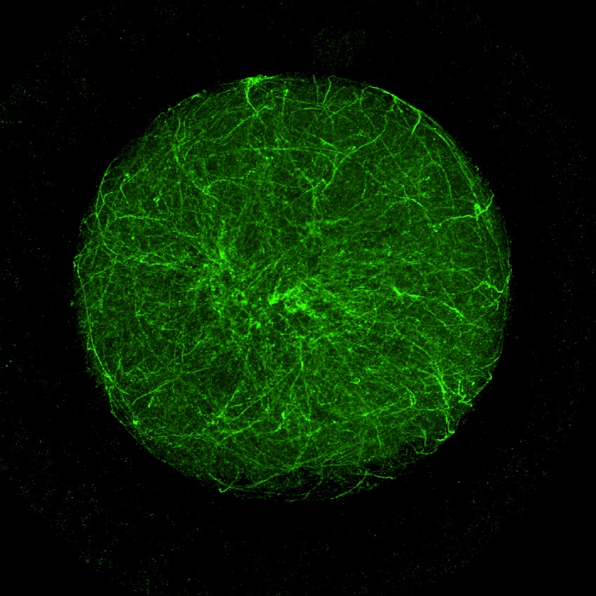 Mikrotubuly myšího vajíčka (průměr 90 µm), které nejen že drží vajíčko pohromadě a ve tvaru koule, ale rovněž slouží jako vodící dráhy pro motorové proteiny a transportní váčky. Trojrozměrná síť cytoskeletu mimoto parceluje cytoplasmu, která podél mi