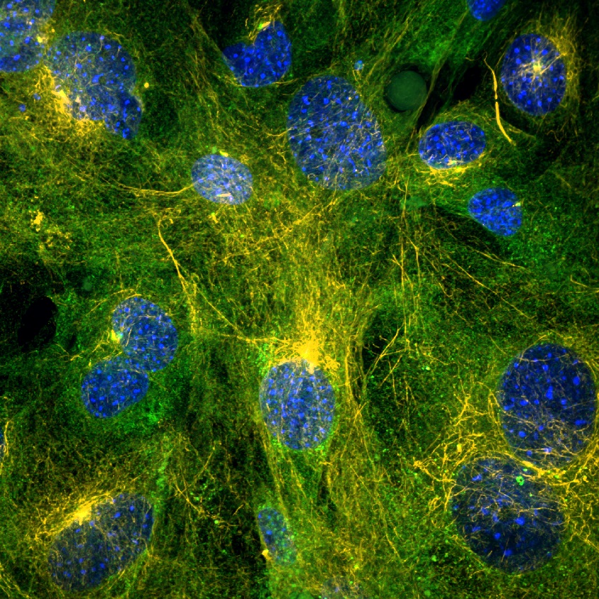 Cytoskelet kožních fibroblastů. Takto členitá buňka to má s vířením o poznání složitější než dokonale kulaté vajíčko, ale nepochybujme, že víří. Jádra jsou obarvena modře, mikrotubuly oranžově (acetylovaný ?-tubulin) a zeleně (?-tubulin). Kredit: Jan