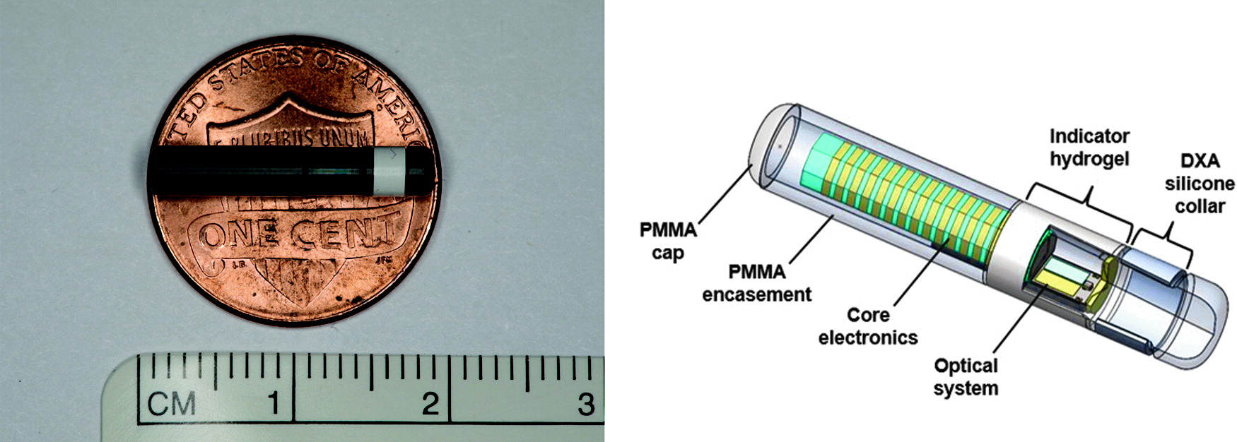 Glukózový senzor Eversense CGM system