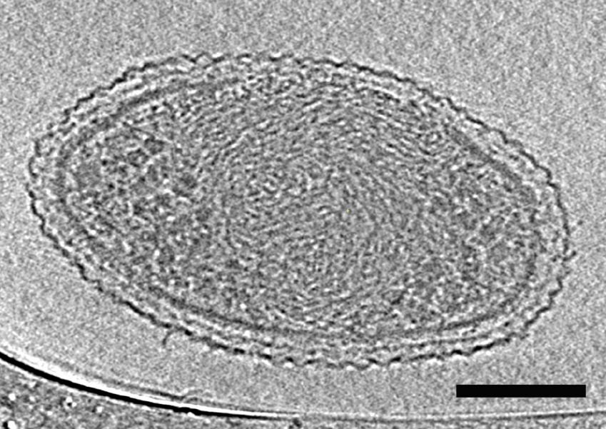 Na skenu je vidÄ›t, Ĺľe objevenĂˇ nanobakterie mĂˇ hustou vnitĹ™nĂ­ strukturu s kompaktnÄ›jĹˇĂ­mi Ăştvary, patrnÄ› ribozomy. ĂšseÄŤka na obrĂˇzku pĹ™edstavuje 100 nanometrĹŻ. Kredit: Berkeley Lab.