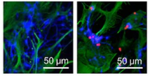 ObrĂˇzky ukazujĂ­ jak neurony uvedenĂ© do stresu dopadnou. Vlevo vÄ›dci astrocytĹŻm jejich ochotu pomĂˇhat ztĂ­Ĺľili.  Neurony s lenivĂ˝mi astrocyty v kontaktu po 48 hodinĂˇch hynou. Na pravĂ©m obrĂˇzku astrocyty svĂ© neurony v jejich ĹˇpatnĂ©m ÄŤase