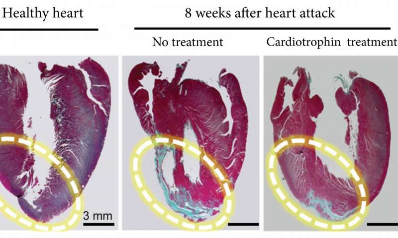 Účinok cardiotrophinu-1 pri experimentálnom infarkte u krysy:Ložisko nedokrvenia (vľavo) sa nezahojilo tenkou väzivovou jazvou (stredný obrázok, modrá farba), ale dorástla v ňom svalovina normálnej hrúbky (obrázok vpravo).  Credit: Cell Research