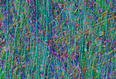 Tkanina z nanovláken připravená novou technologií JetValve pohledem rastrovacího elektronového mikroskopu. Odborníkům z obrázku má být zřejmé, že síťování se tomu v chlopních přirozených, podobá jak vejce vejci. (Kredit: Wyss Institute, Harvard Unive