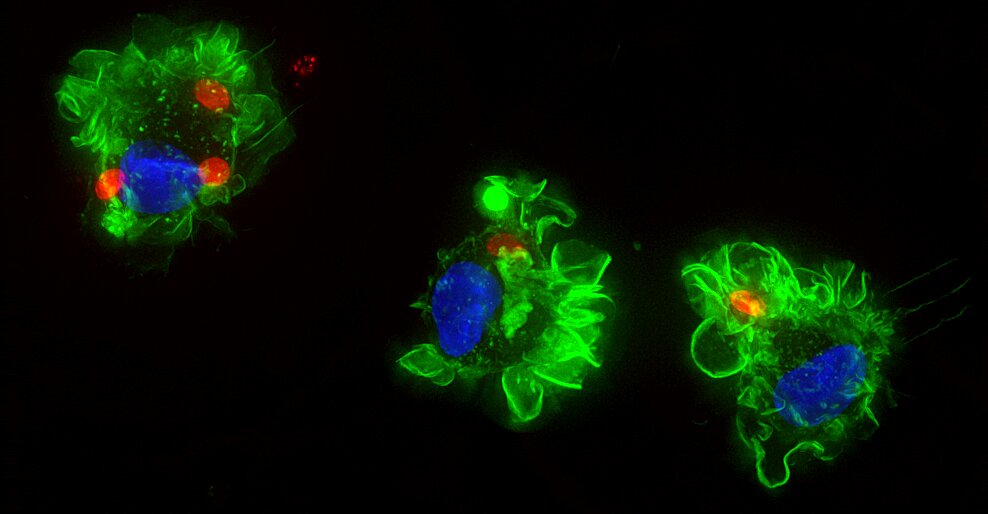Skupina infikovaných imunitních buněk infikovných parazitem. Toxoplasma (červená). Povrch buňky je zbarven zeleně a jádro buňky modře (obrázek: Antonio Barragan). Kredit: Antonio Barragan