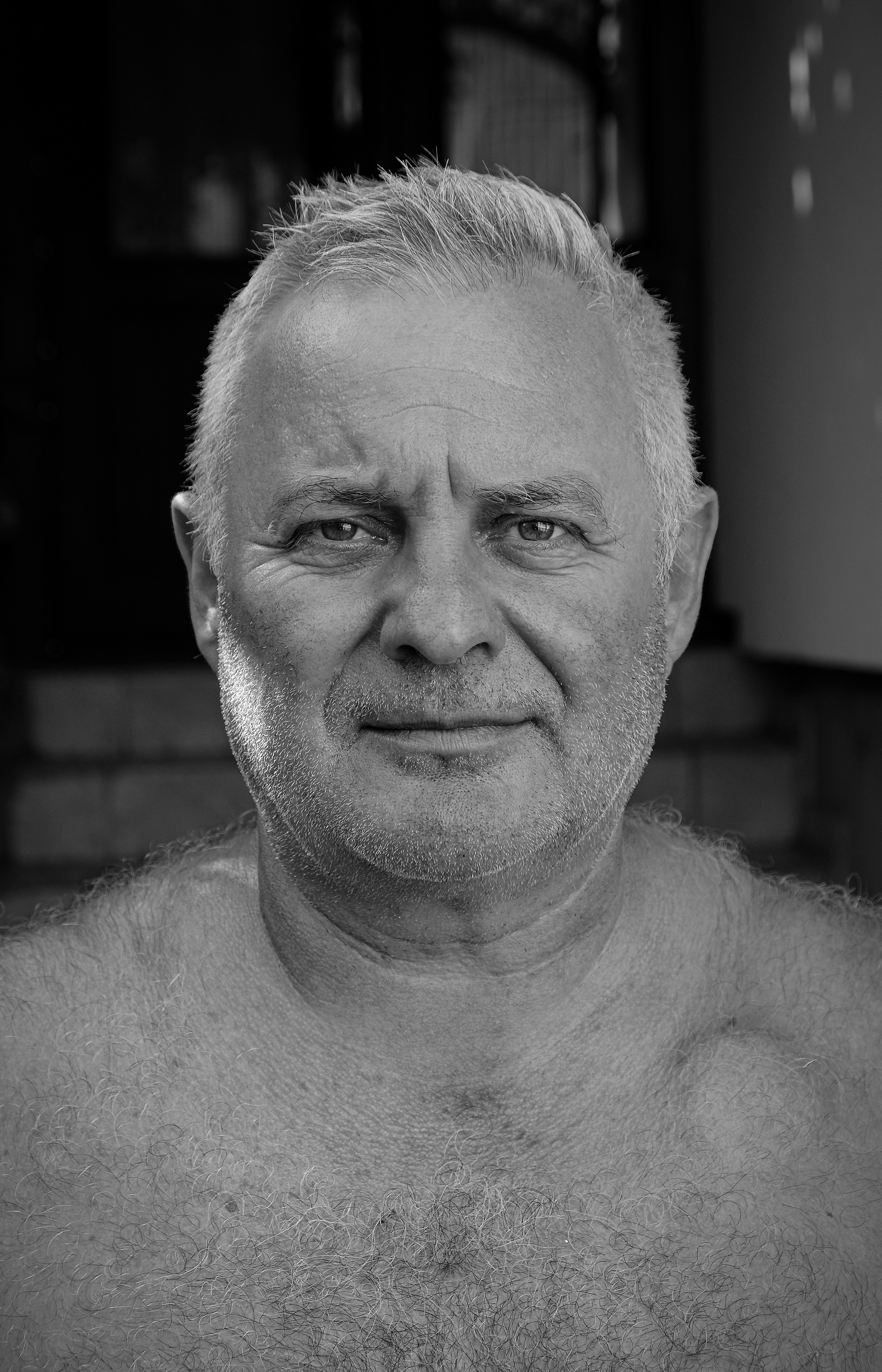 Pacient s kardiostimulátorom, implantovaným pod kožu pod ľavou kľúčnou kosťou. Kredit: Unsplash.