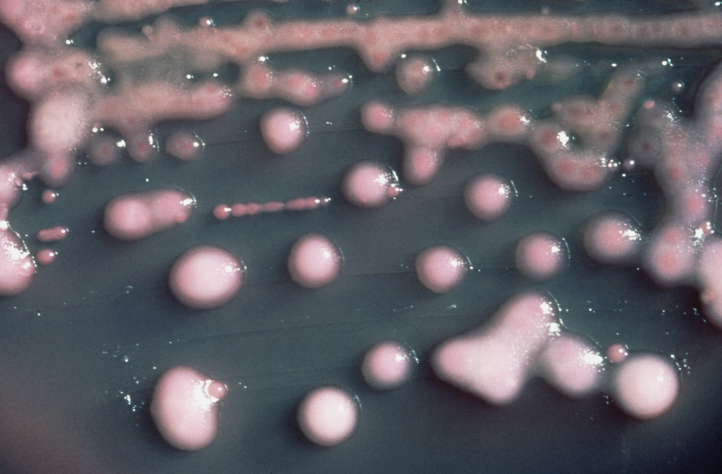 Klebsiella pneumoniae, Kredit: MacConkey, Wikipedia.