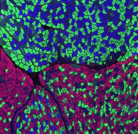 Až speciální barvení řezu lýtkovým svalem ukáže, že je tvořen třemi typy svalových vláken: pomalými oxidativními (modře), rychlými oxidativními (zeleně) a rychlými glykolytickými (červeně). Běžcům maratonů se tvrdým tréningem posouvá zastoupení ve pr