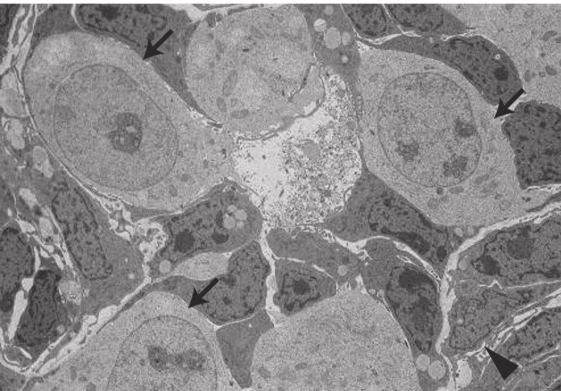 Lidské indukované kmenové buňky (označeny černými šipkami) v umělém vaječníku v němž myší buňky těm lidským hrají roli školitelek k jejich přeměně na buňky pohlavní (vajíčka). Školitelky jsou ty tmavší, jedna je označena trojúhelníčkem. Kredit: Chika