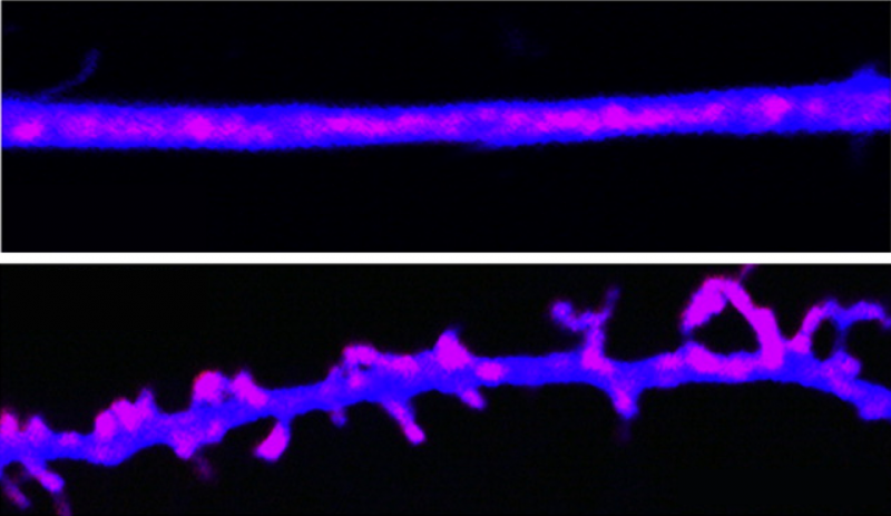 PamÄ›ĹĄovĂ© stopy jsou uklĂˇdĂˇny pomocĂ­ prionovĂ˝m proteinĹŻm podobnĂ˝m molekulĂˇm. VÄ›dci je nazvali CPEB. V mozku udrĹľujĂ­ synapse (spodnĂ­ ÄŤĂˇst obrazu). Â KdyĹľ CPEB priony inaktivujeme, synapse se hroutĂ­ a pamÄ›ĹĄ slĂˇbne (viz stejnĂ˝ neuro