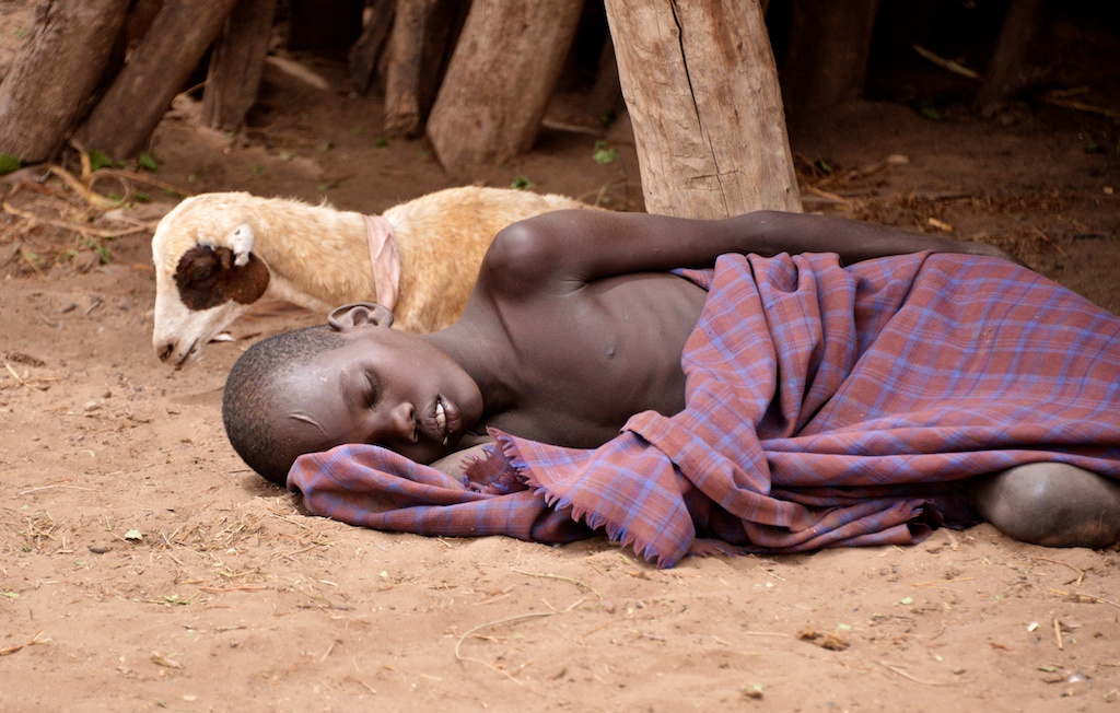 Etiópske dieťa s maláriou. Autor: Rod Waddington, Wikimedia org. CC BY-SA 2.0