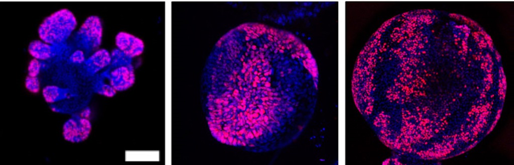 Organoidy s imunohistochemickým barvením k vizualizaci počtu dělících se buněk. Obrázek je z dílny kolektivu Ming Guo. (Kredit MIT).