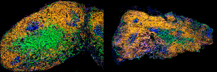 Porovnání lymfatické uzliny mladé (vlevo) a stárnoucí myšky (vpravo) v čase čtrnáct dní po imunizaci. B buňky jsou obarveny žlutě, množící se buňky zárodečných center modře.  T buňky jsou zobrazeny zeleně. Kredit: Stebegg a kol, eLife, 2020