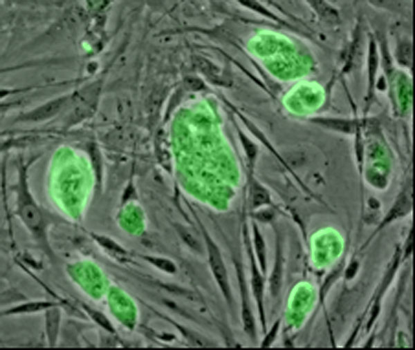 Kmenové buňky jsou buňky oplývající schopností se dělit a přeměny v jiný typ buněk. Jejich přítomnost v těle umožňuje opravit poškozené části těla tvořené specializovanými buňkami, které se dělit nemohou. Kredit:  National Science Foundation, volné d