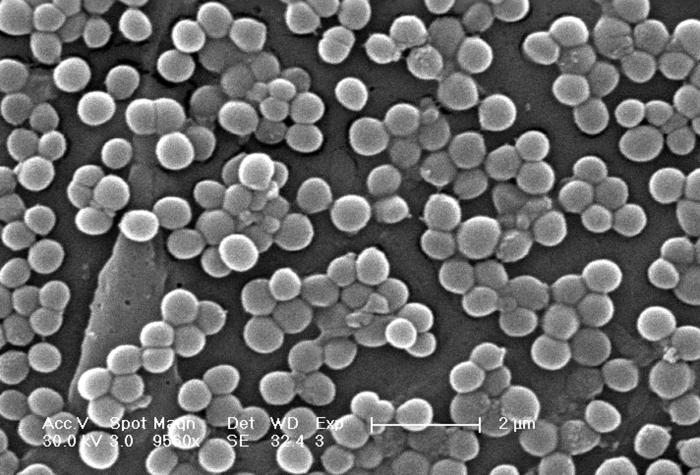 Shluky bakterie Staphylococcus aureus rezistentních vůči meticilinu (MRSA); Snímek z rastrovacího elektronového mikroskopu zvětšeno 9560x. (Kredit: Janice Carr, Wikipedia, volné dílo)