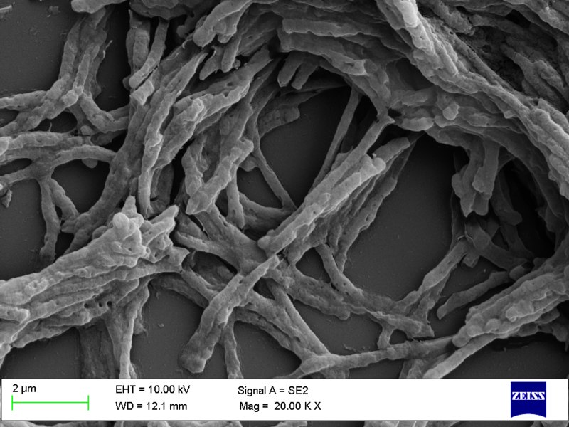 Mycobacterium smegmatis. Kredit: Vader1941 / Wikimedia Commons. CC BY-SA 4.0