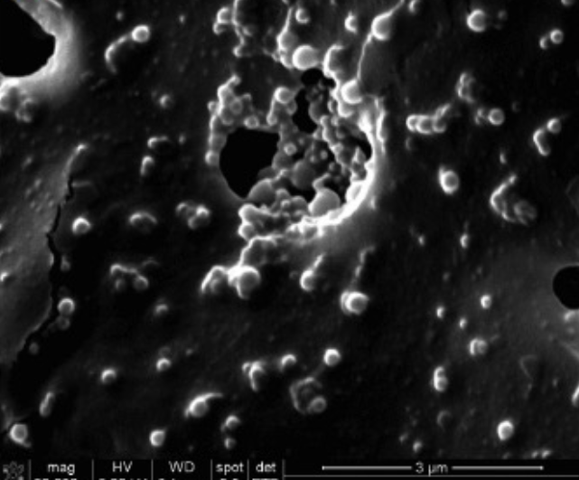 Nanobomby v elektronovĂ©m mikroskopu. SkrĂ˝vajĂ­ nĂˇplĹ? syntetickĂ˝ch molekul mikroRNA, coĹľ je â€žsoftvĂ©râ€ś, kterĂ˝ zasahuje do aktivity genĹŻ a pomatenĂ© buĹ?ky pĹ™emlouvĂˇ k sebevraĹľdÄ› (apoptĂłze). (Kredit: Hai Wang, OSU 2015)