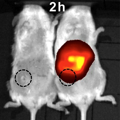 NanoÄŤĂˇstice proti nĂˇdorovĂ˝m kmenovĂ˝m buĹ?kĂˇm. Kredit: American Chemical Society.