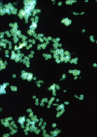 Centrum pro kontrolu a prevenci nemocí (CDC) zařadilo Neisseria gonorrhoeae do první pětky naléhavých hrozeb tzv. drug resistance.