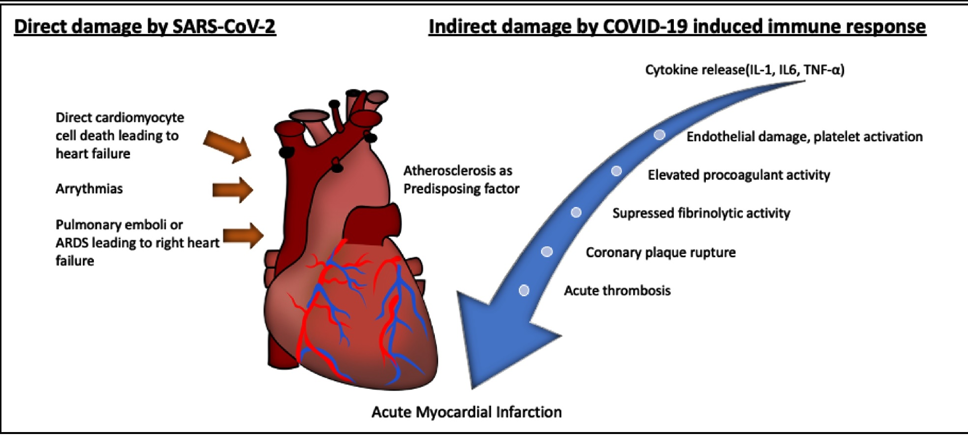 Mechanismus kterým SARS-CoV-2 poškozuje srdce. Kredit: Zubair Akhtar, Eur Heart J Suppl, 2023.