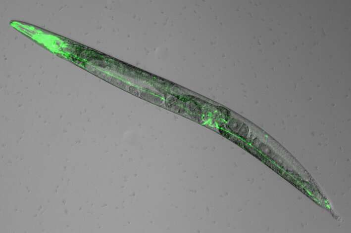 Neurony háďátka Caennorhabditis elegans s receptorem pro melanin zviditelněné zelenou fluorescenční barvičkou. Kredit: Bojun Chen/UConn Health.