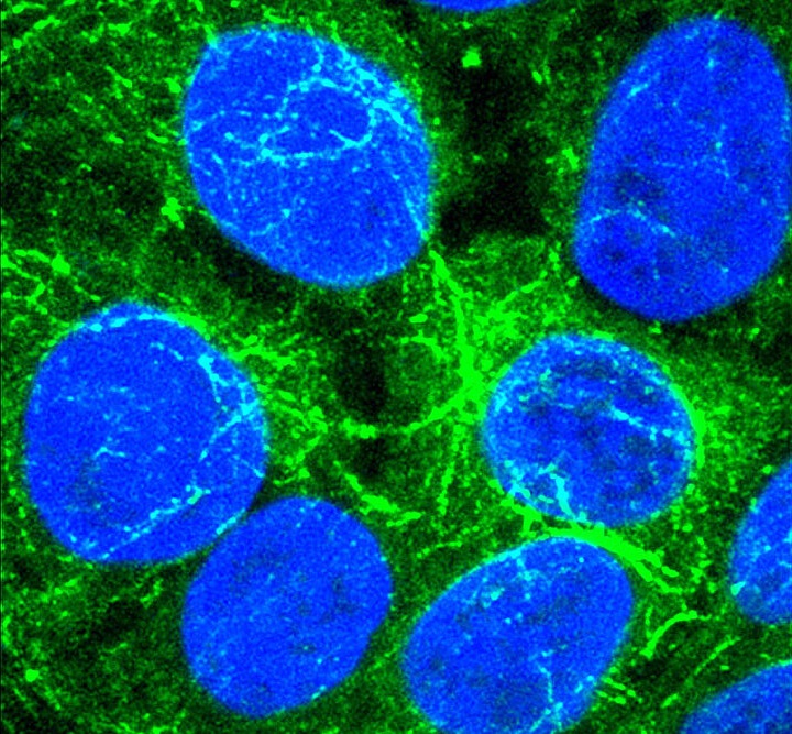 Když buňkám chybí kritický signální enzym (jaterní buňky na preparátu jsou obarveny modře), uchylují se ke komunikaci a sdílení zdrojů prostřednictvím vezikul (zeleně). Tato strategie dovoluje buňkám se množit i v prostředí, které to jiným buňkám ned