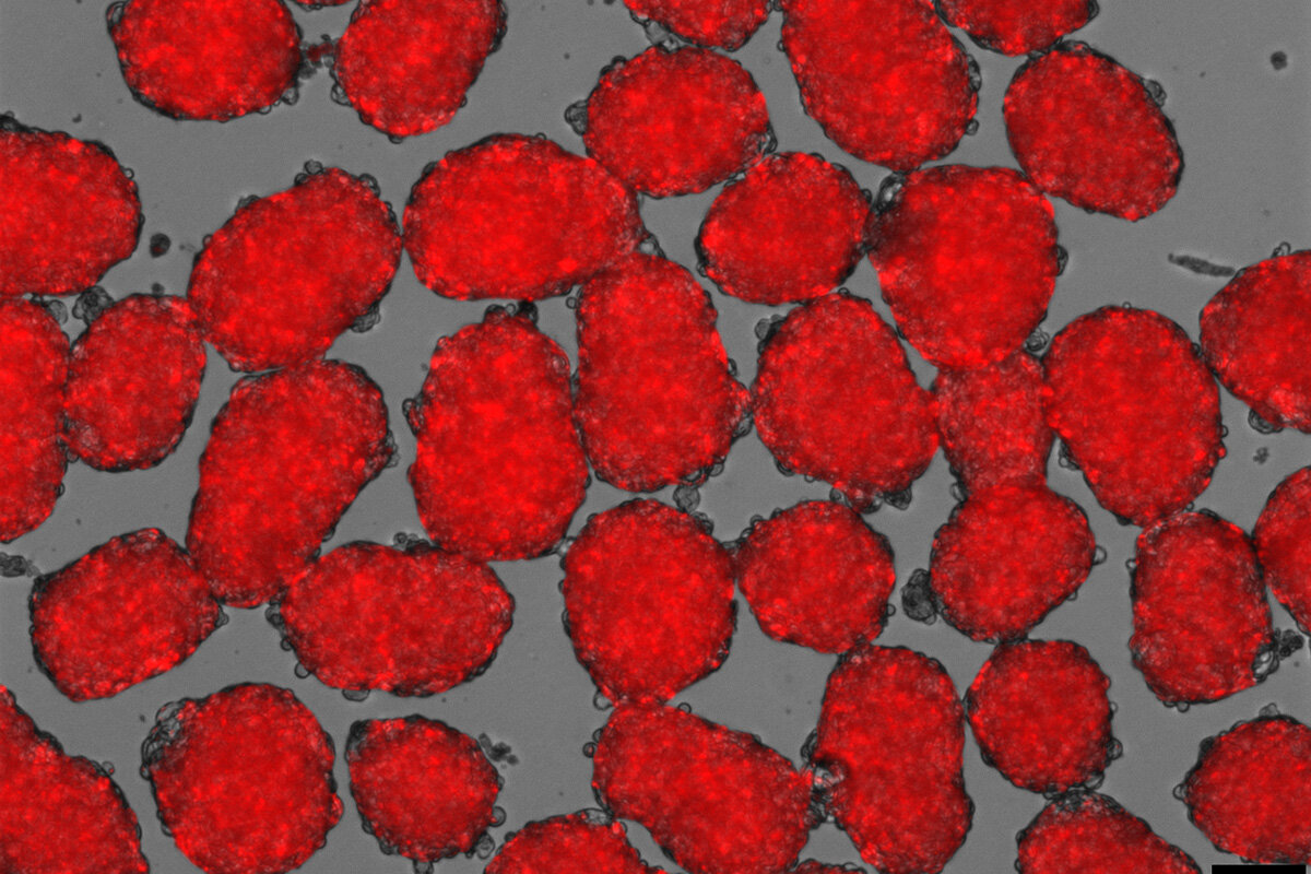 Uměle připravené beta buňky se zobrazují červeně, protože v odpovědi na glukózu začaly vylučovat inzulín. Kredit: Millman lab, Washington University.