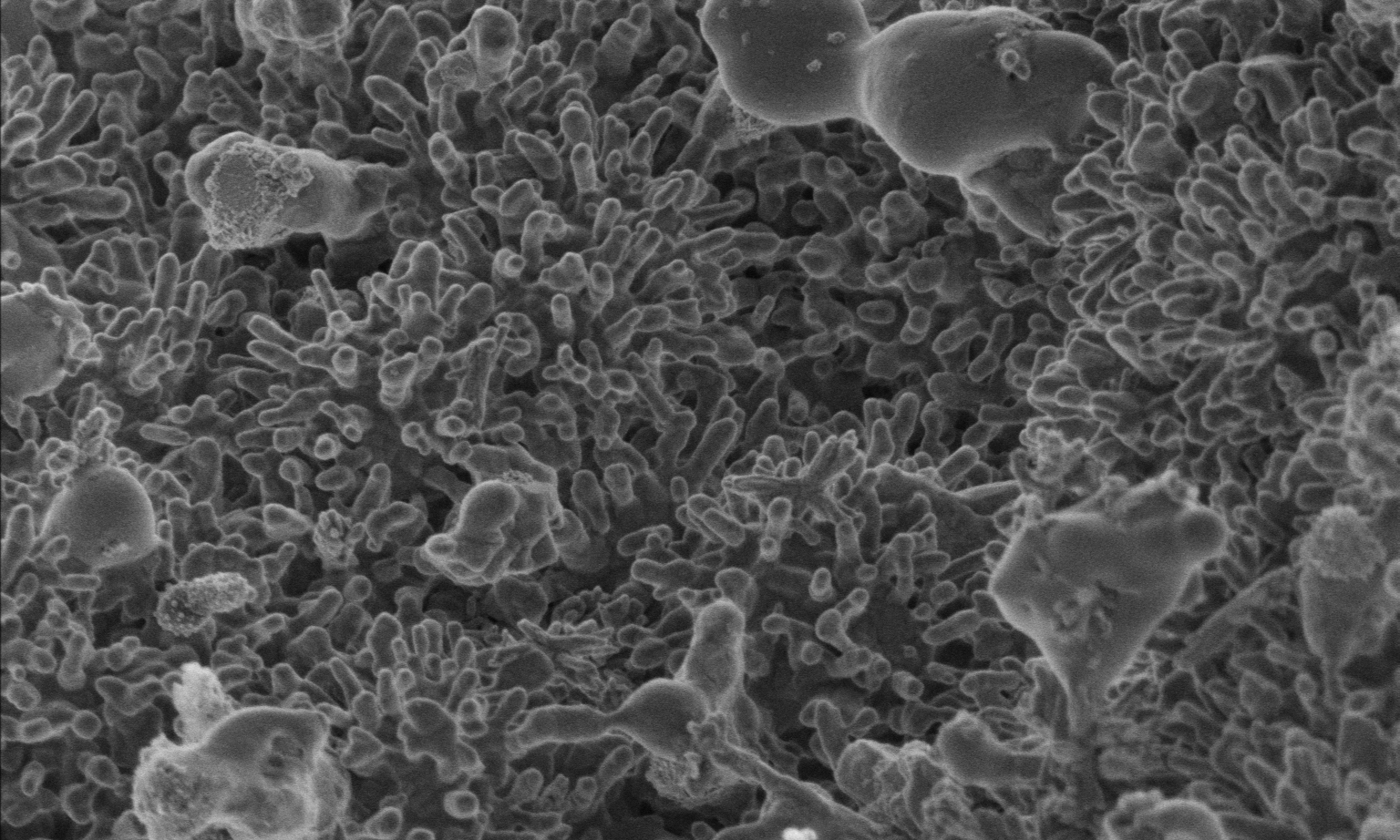 Uhlíkový nanomateriál (50 00krát zvětšeno), vytvořený při zpracování odpadní vody novým postupem. Kredit: RMIT.
