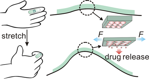 ElastickĂˇ nĂˇplast s mikrokapslemi zaÄŤne uvolĹ?ovat drogu aĹľ pĹ™i nĂˇroÄŤnÄ›jĹˇĂ­m pohybu. (Kredit: Jin Di, University of North Carolina at Chapel Hill, 2015)