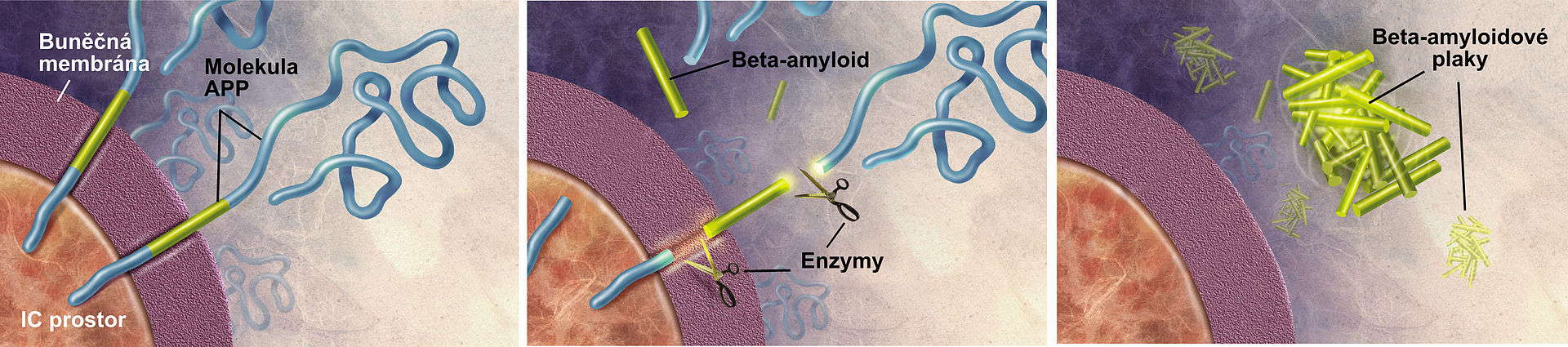 Enzymy působí na APP (Amyloid prekurzorový protein) and rozdělují je na fragmenty, z nichž jeden je nazýván beta-amyloid a má úhlavní roli v tvorbě Alzheimerových plaků.  Kredit: Alzheimer's Disease Education and Referral Center,  National Institute 