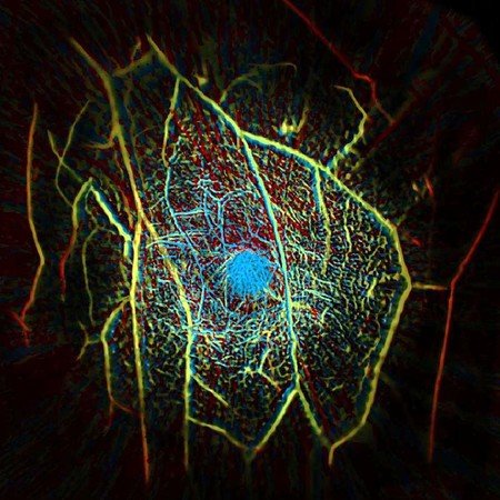 Snímek cévní struktury uvnitř prsu získaného skenováním pomocí fotoakustické počítačové tomografie.  Kredit: Caltech