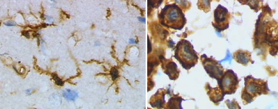 Mikroglie v klidovém stavu (vlevo) a v stadiu aktivních makrofágů (vpravo) v mozku laboratorního potkana (obarvené hnědě). Vysvětlení v prvním videu pod článkem Kredit: Grzegorz Wicher, Wikipedia, volné dílo.
