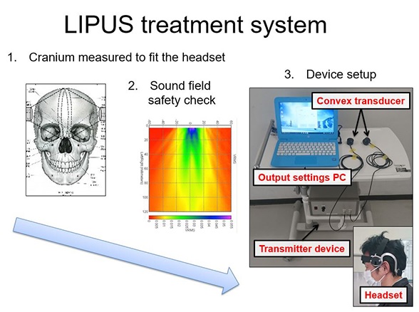 Přístroj na léčbu lidského mozku metodou LIPUS. Snad zatím slouží jenom ke klinickým testům a snad je provádí zcela nezávislý tým. Kredit: Tohoku University.