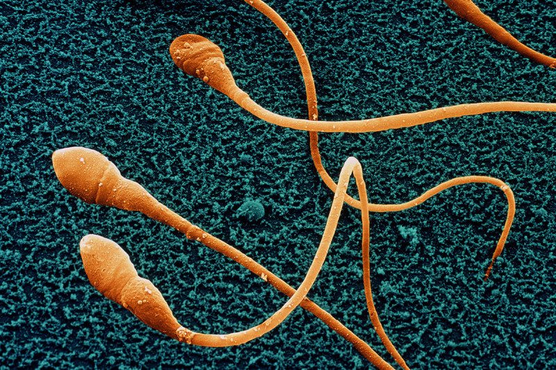 Na věku záleží. Kredit: Juergen Berger/SPL