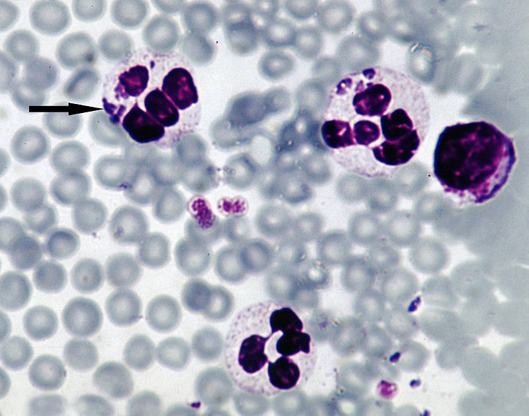 Parazit Anaplasma p. infikuje bílé krvinky. (Kredit: Wikimedia Commons CC BY-SA 3.0)
