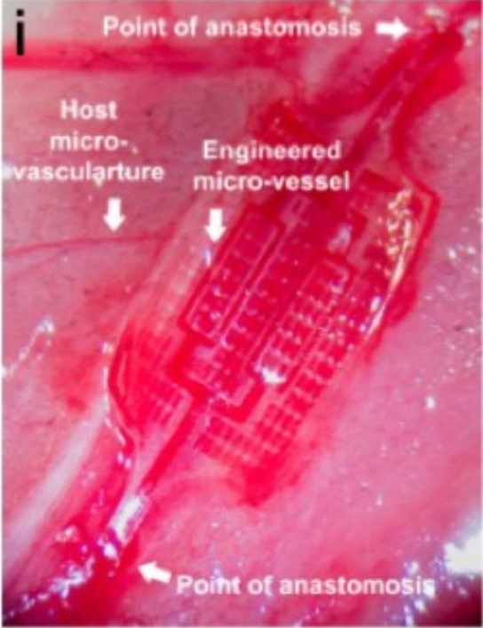 Robustnější a již prověřená srdeční záplata AngioChip, je loňským úspěchem laboratoře vedené prof. Milica Radisic. Dvě místa označená šipkami s popiskou 