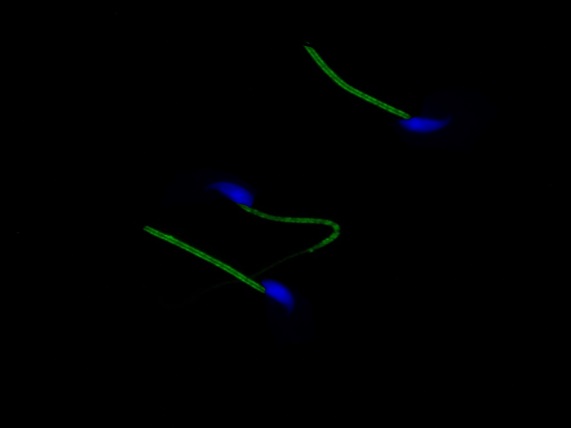 Persulfidace (chcete-li sulfhydratace) v myších spermiích. Jak je vidět, persulfidace zasahuje především proteiny, nacházející se v blízkosti mitochondrií. Mitochondrie vyrábějí pro spermii nezbytnou energii, ale současně jsou největšími producenty v