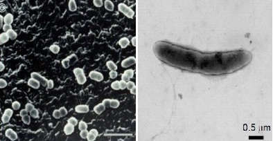 PrevotellaÂ gramnegativnĂ­ anaerobnĂ­ fermentujĂ­cĂ­ tyÄŤky (vlevo) se od  Oscillibacteru vzhledovÄ› prakticky neliĹˇĂ­. ObÄ› bakterie produkujĂ­ metabolity tlumĂ­cĂ­ ve stÄ›nÄ› stĹ™eva mnoĹľenĂ­ bunÄ›k Th17. K Kredit:ďĽ?NITE NBRC) é›»ĺ­?éˇ•ĺľ®éŹˇĺ†™