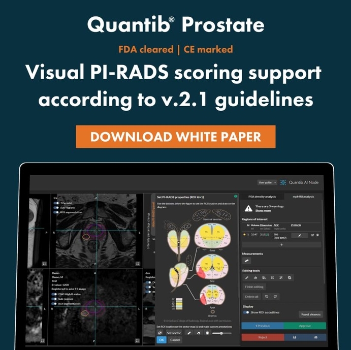 Nástroj AI na hodnotenie MRI nálezov na prostate. (Kredit:  Quantib).