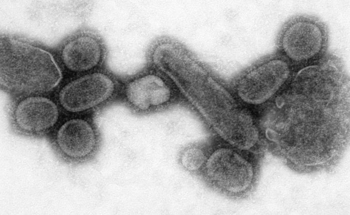 Ačkoliv původce pocházel z Asie, paradoxně se mu přezdívalo „španělská chřipka“. Šlo o virus A H1N1. Typem tedy stejný virus u něhož kultivace na vejcích se může zavinit problém neúčinnosti. Je proto obávanou hrozbou dodnes. Kredit: CDC.