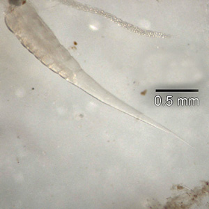 Do Ĺ™Ăˇdu hlĂ­stice patĹ™Ă­ i Roup dÄ›tskĂ˝Â (Enterobius vermicularis). I tento parazit by mohl tak jako mÄ›chovec zamÄ›stnĂˇvat imunitnĂ­ systĂ©m a brĂˇnit rozvoji revmatoidnĂ­ artritidy. (Kredit: Division of Parasitic Diseases and Malaria (DPDM) of