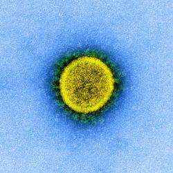 Pohled na virus SARS-CoV zprostředkovaný elektronovým mikroskopem. Uměle počítačem dobarveno. Kredit: National Institute of Allergy and Infectious Diseases, NIH.