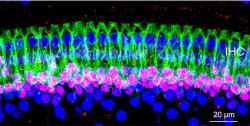 Ze skryté ztráty sluchu bylo viněno vnitřní ucho. Konkrétně ztráta synapsí mezi vláskovými buňkami (zeleně) a výběžky neuronů (čeveně). Újmu tohoto typu si snadno přivodíme i hlasitým poslechem ze sluchátek. Nový poznatek ale svědčí ještě o něčem jiném. Příčinou nemusí být jen záliba v rockových koncertech. (Kredit: University of Michigan)