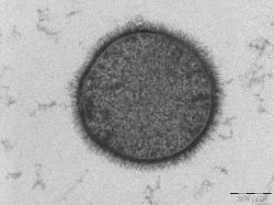 Bacillus subtilis, česky někdy označovaný jako bacil senný. Jde o aerobní nepatogenní bakterii, která žije v půdě. Foto: Allon Weiner, The Weizmann Institute of Science, Rehovot, Israel