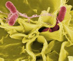 Bakterie Salmonella typhimurium, původce úporných průjmových onemocnění. Snímek z elektronového mikroskopu, uměle dobarveno. Kredit NAID, volné dílo.