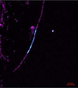 Tyrkysově intronová RNA predátora v buňkách kořisti. Kredit: Jens Harder / MPI for Marine Microbiology.
